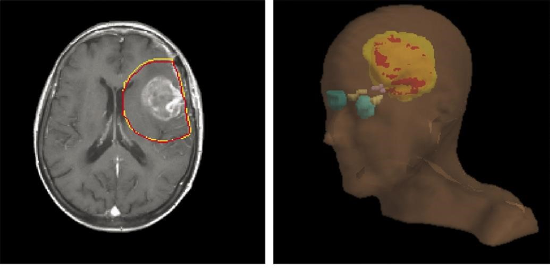 IDL Fellow Radiation Image